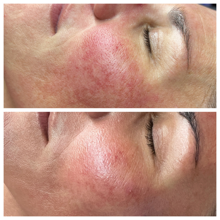Be Still Peptide Serum